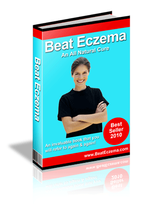 Beat Eczema Review By Susan Clark 